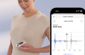 A BeamO „a jövő hőmérője” már az FDA által jóváhagyott és elérhető az Egyesült Államokban